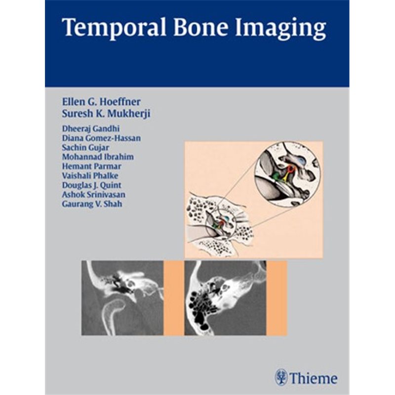 Temporal Bone Imaging